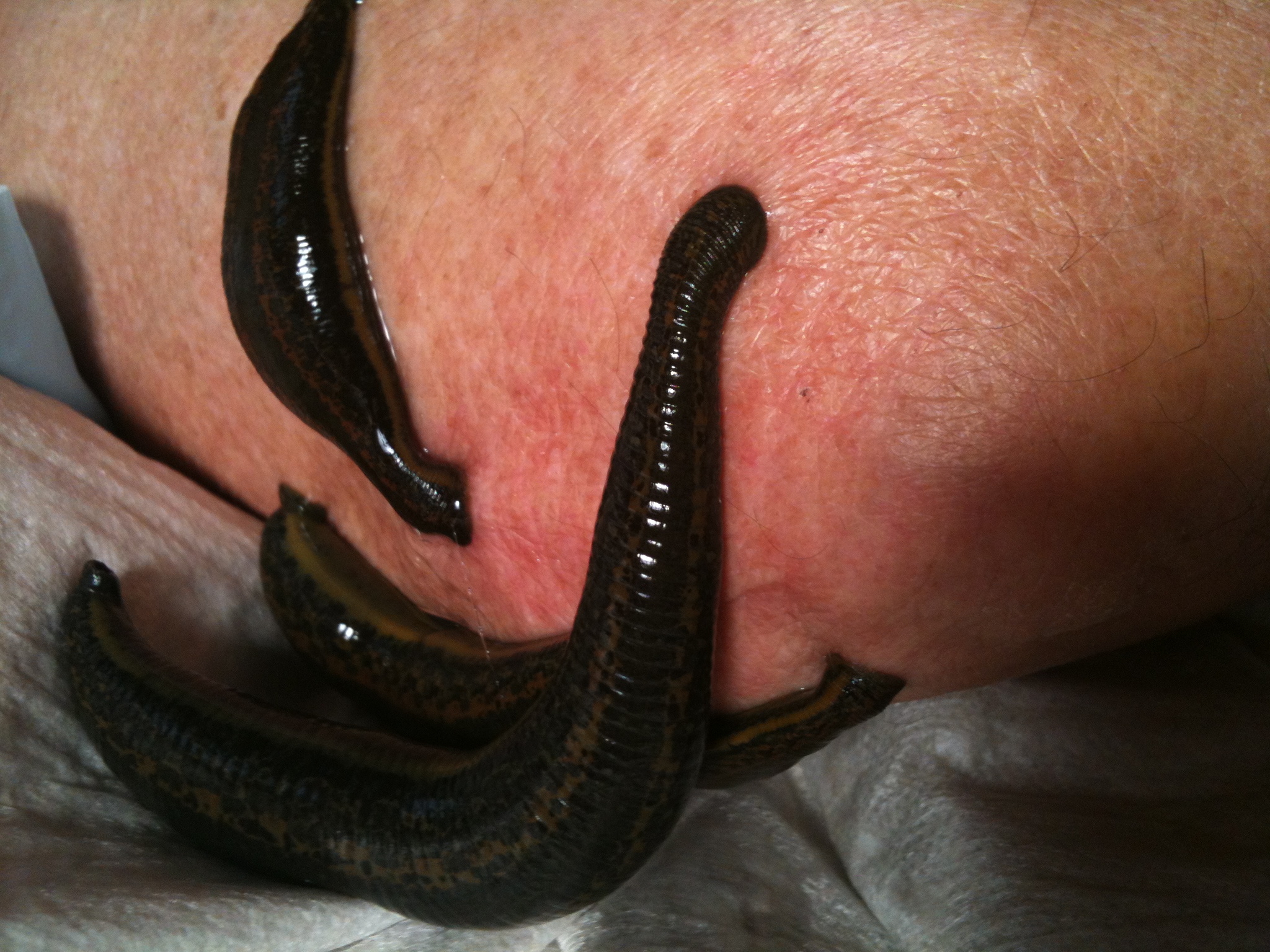 Blutegel für Homepage